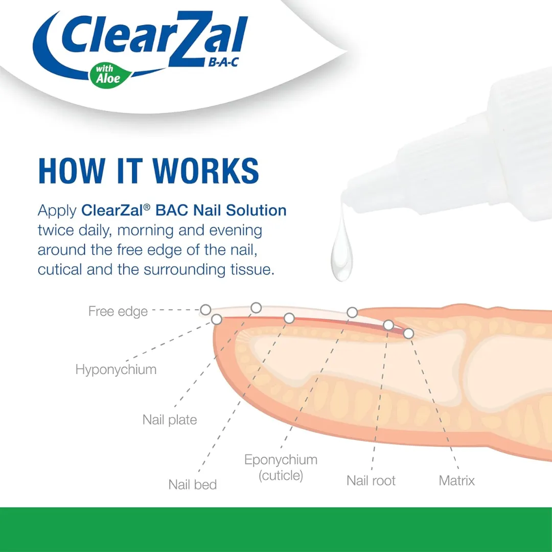 ClearZal Fungal Nail Treatment | Antimicrobial Nail Solution 30ml (T)